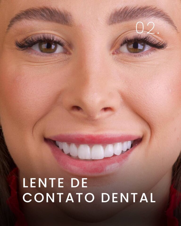 Lente De Contato Dental