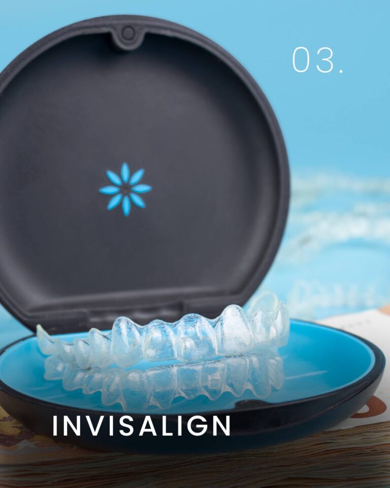 Invisalign em Curitiba